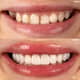 Slider image (10) Jimer Dental Clinics